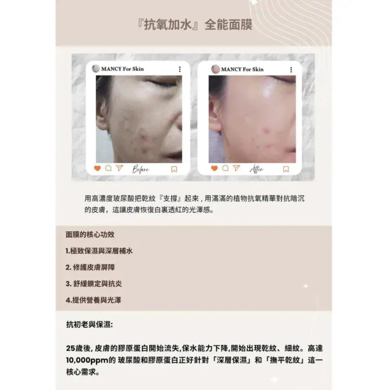 【Mancy For Skin】 精華護膚系列|精華素、精華面膜|強靭肌膚底層至真皮層|深層補水|減少暗沉和抗氧化|舒緩鎖定與抗炎|修護皮膚屏障【逢星期日截單, 預計 : 3至4星期發貨】