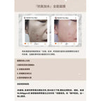 【Mancy For Skin】 精華護膚系列|精華素、精華面膜|強靭肌膚底層至真皮層|深層補水|減少暗沉和抗氧化|舒緩鎖定與抗炎|修護皮膚屏障【逢星期日截單, 預計 : 3至4星期發貨】